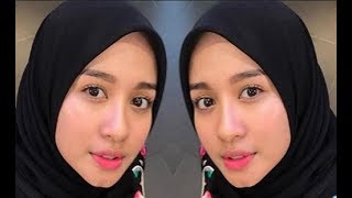 Heboh Laudya Chyntia Bella Punya Tato Di Pinggul, Ini Gambar yang Dipilih Istri Engku Emran