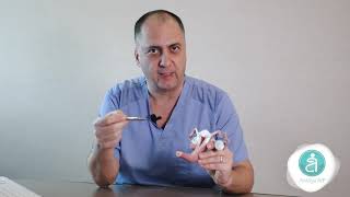 Doç.Dr. Murat BERKKANOĞLU -Endometrial polipler tüp bebek tedavisine engel olurmu ?