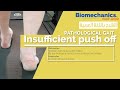Pathological gait insufficient push off  biomechanics made simple
