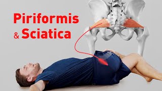 Piriformis Syndrome & Sciatica - Stretching Exercises