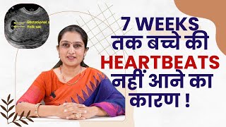 Why Heart Beat Never Comes In Early Pregnancy ?