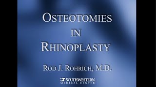 5  Osteotomy in Rhinoplasty