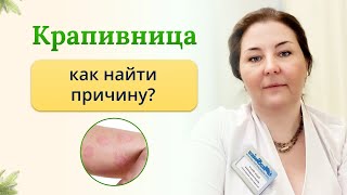 Крапивница - заболевание или симптом? Как и где найти причину? Отвечает Врач-иммунолог Ольга Брум