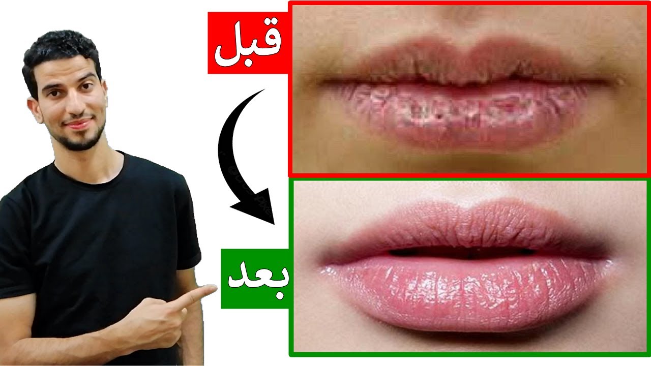 حول شفتيك من داكنه باهته جافة الي لامعه كبيرة رطبة في دقائق ✅