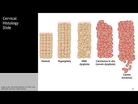 Thumbnail for the embedded element "Incidence and Etiology of Cancer - Introduction to the Biology of Cancer #3"