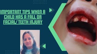 4 IMPORTANT TIPS💡 IF CHILD HAS FALLEN & HAS DENTAL INJURY -  by Dr PRITI NARWANI