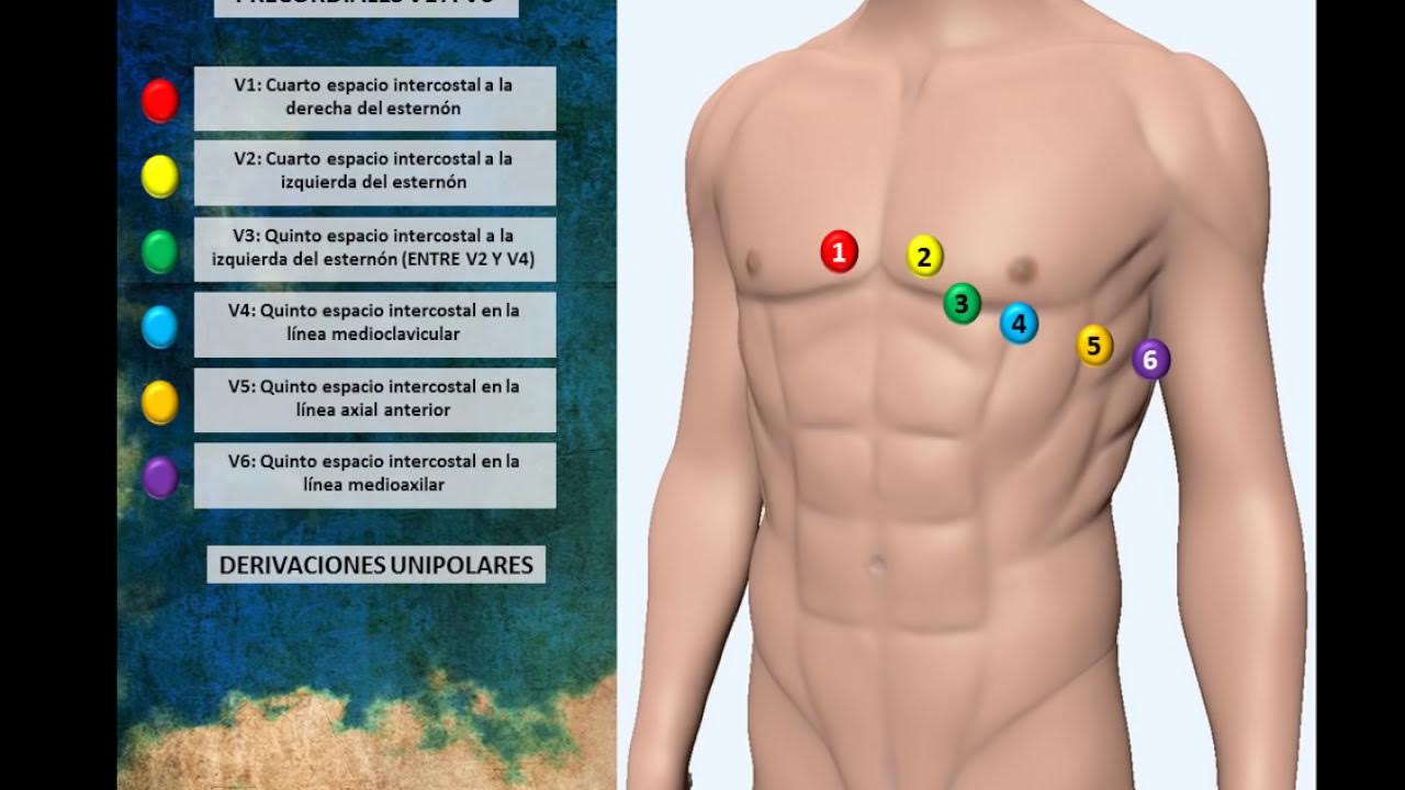 Экг как снимать правильно расположить Electrocardiograma 01 (Colocación Correcta de Electrodos) - YouTube