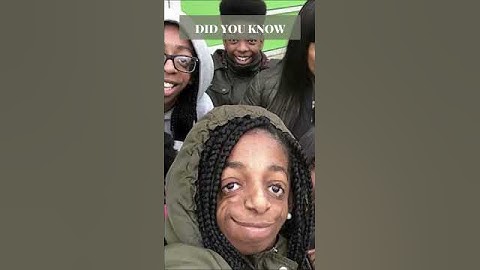 Shocking Reality of Treacher Collins Syndrome #shorts