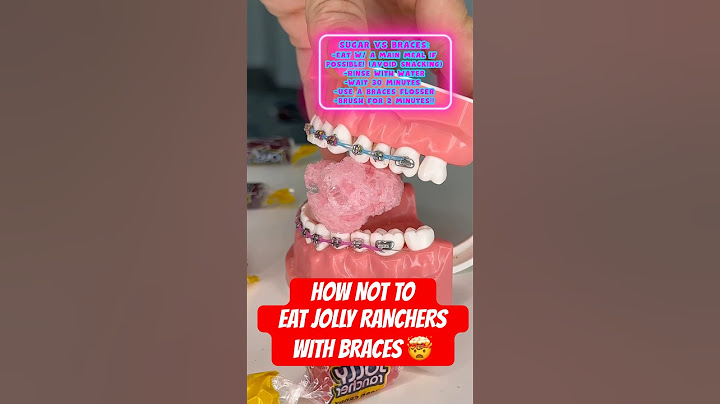 How NOT to eat JOLLY RANCHERS with BRACES 🤯 #braces #candy #crunchy