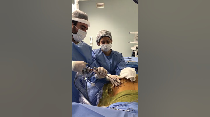 Cirurgia de Endoscopia de Coluna com Dr. Luciano Pellegrino