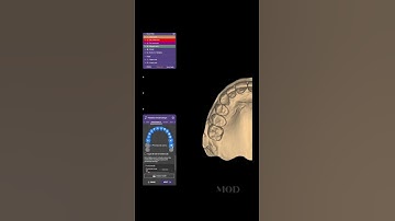 Create 3D model in exocad #dentist #satisfying #exocad