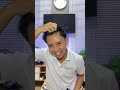 Rambut Rontok