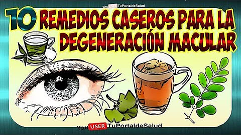 ¿Cuál es el mejor remedio natural para la degeneración macular?