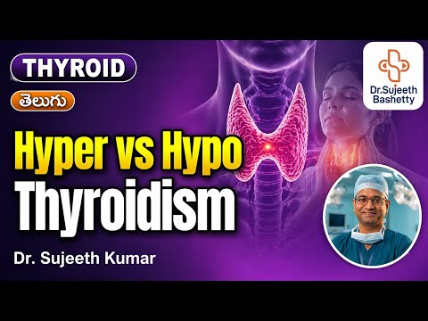 Video: Hyperthyroidism vs hypothyroidism