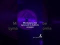 Milenburg joys Abe Lyman and his California Orchestra Brunswick 6325