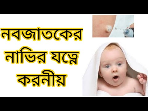 ভিডিও: কিভাবে নবজাতকের নাভি চিকিত্সা করা যায়