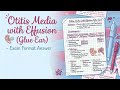 Otitis Media with Effusion (Glue Ear) | ENT Exam Answers &amp; Viva