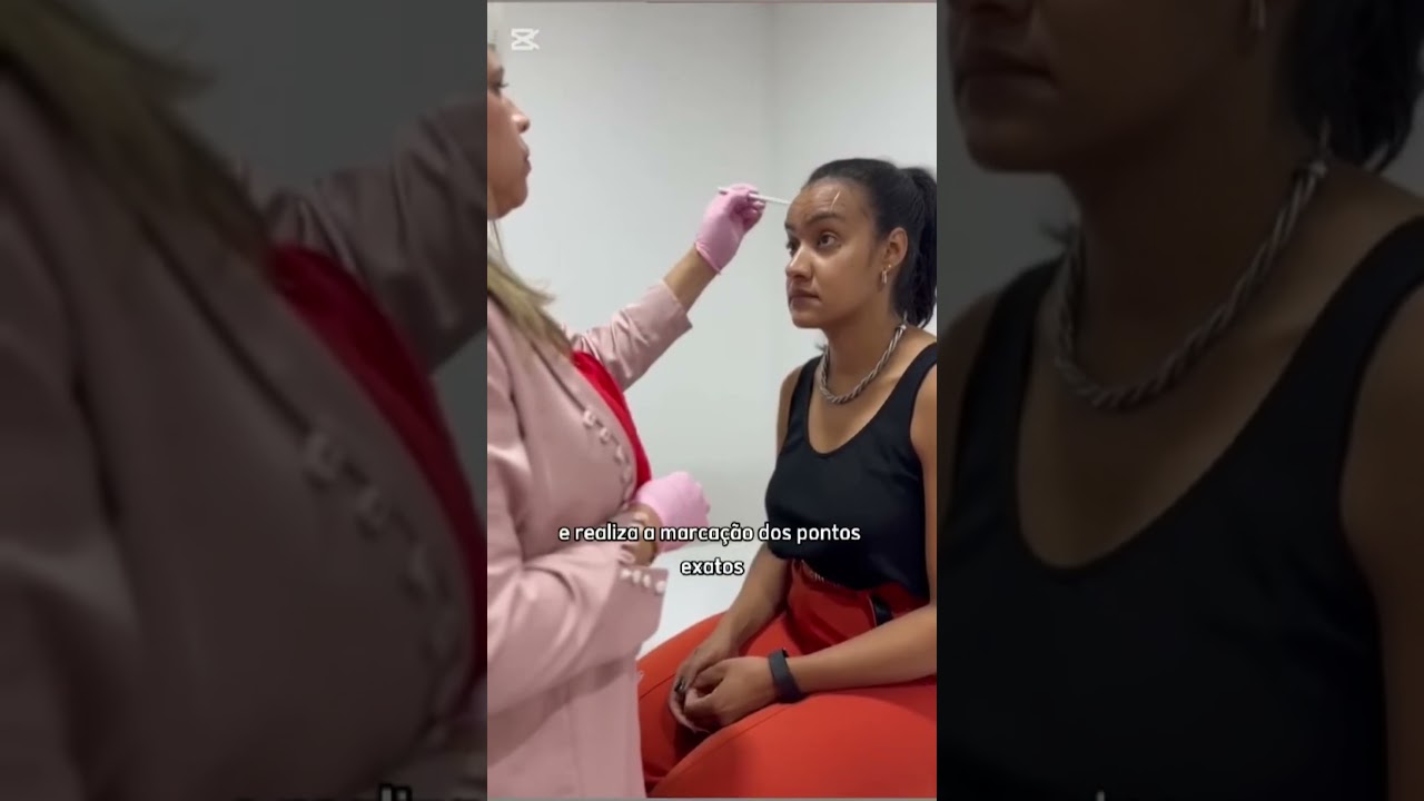 Toxina Botulínica na Vila Leopoldina SP - Studio Taty Vicente