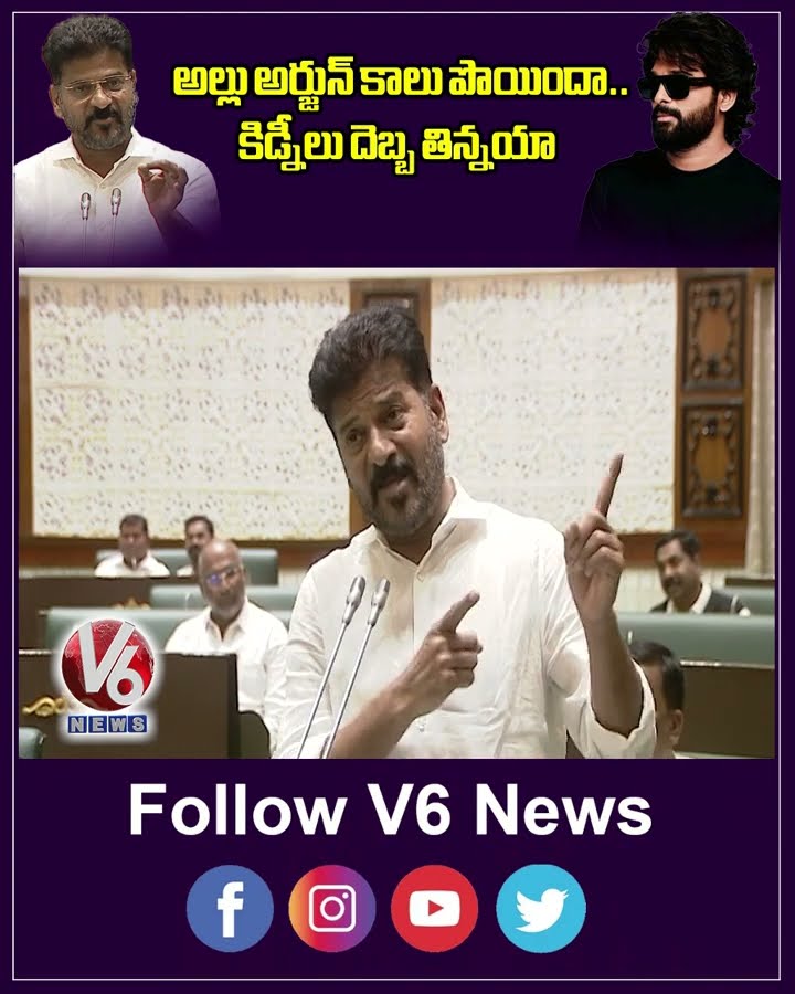 అల్లు అర్జున్ కాలు పొయిందా  కిడ్నీలు దెబ్బ తిన్నయా | Revanth Reddy | Allu Arjun |V6News