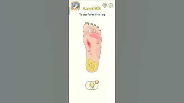 DOP 2 LEVEL 281 | Transform the Leg