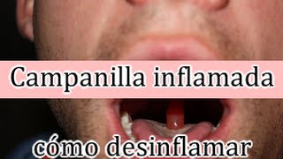Uvula papilloma tünetei, Betegségek szövődménye