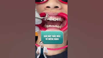 TRẢ LỜI CÁC CÂU HỎI VỀ NIỀNG RĂNG #braces #niengrang