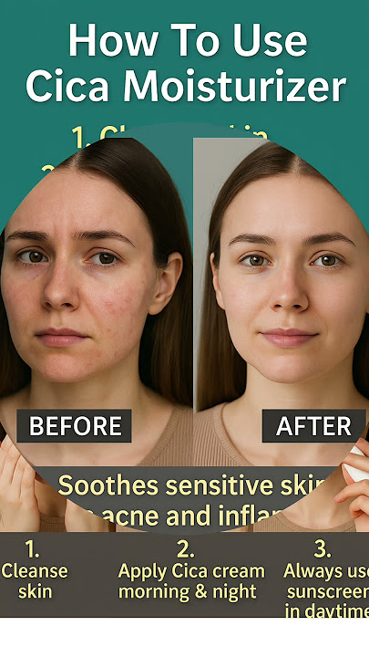 CICA Moisturizer: What It Is & Why Your Skin Will Love It #skincaretips  #arpitazdiybeautyhacks#cica