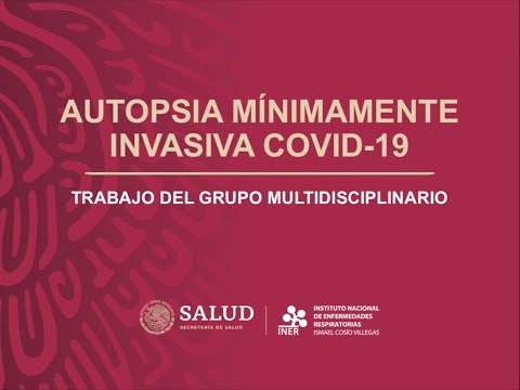 Vídeo: Lo Que Se Revela Durante La Autopsia De Las Víctimas Del Coronavirus - Vista Alternativa