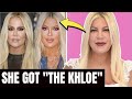 Tori Spelling (90210): Plastic Surgery - Khloe Kardashian Inspired? | "I didn't get surgery"