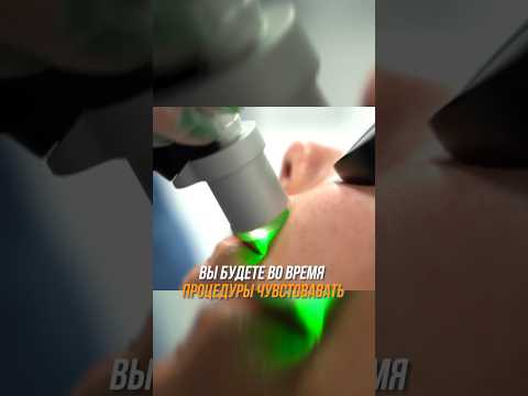 Больно ли делать Лазерную Эпиляцию?🫣 #вопросответ #топ #рекомендации