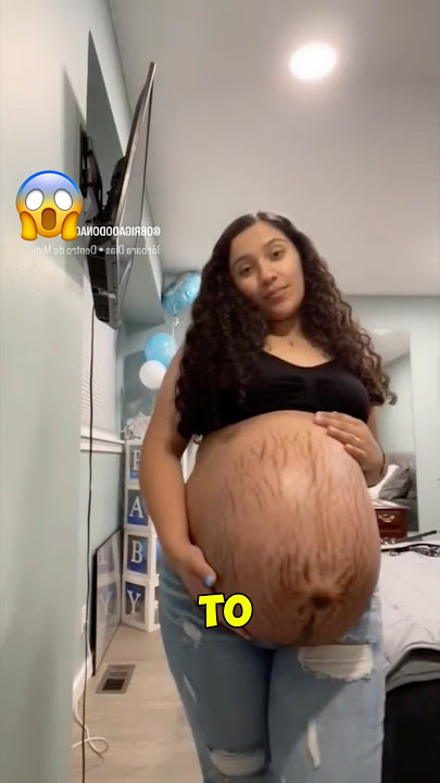 This woman was pregnant with 5 babiesโฆ and what happened during birth will shock you! ๐ฑ #shorts