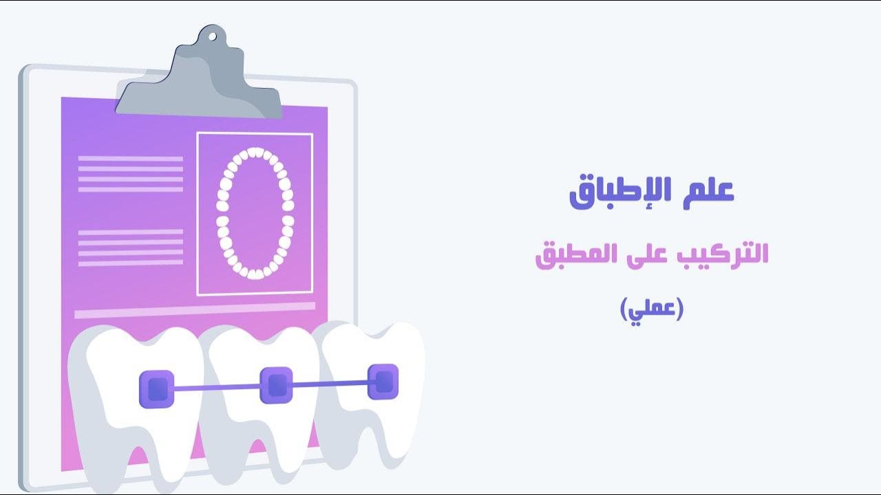 طريقة تركيب الأمثلة على المطبق