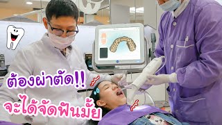 นนนี่มาตรวจฟันรอบ 2 ปี เจอฟันคุด ต้องผ่าตัดขากรรไกร จะได้จัดฟันไหม? [Nonny.com]