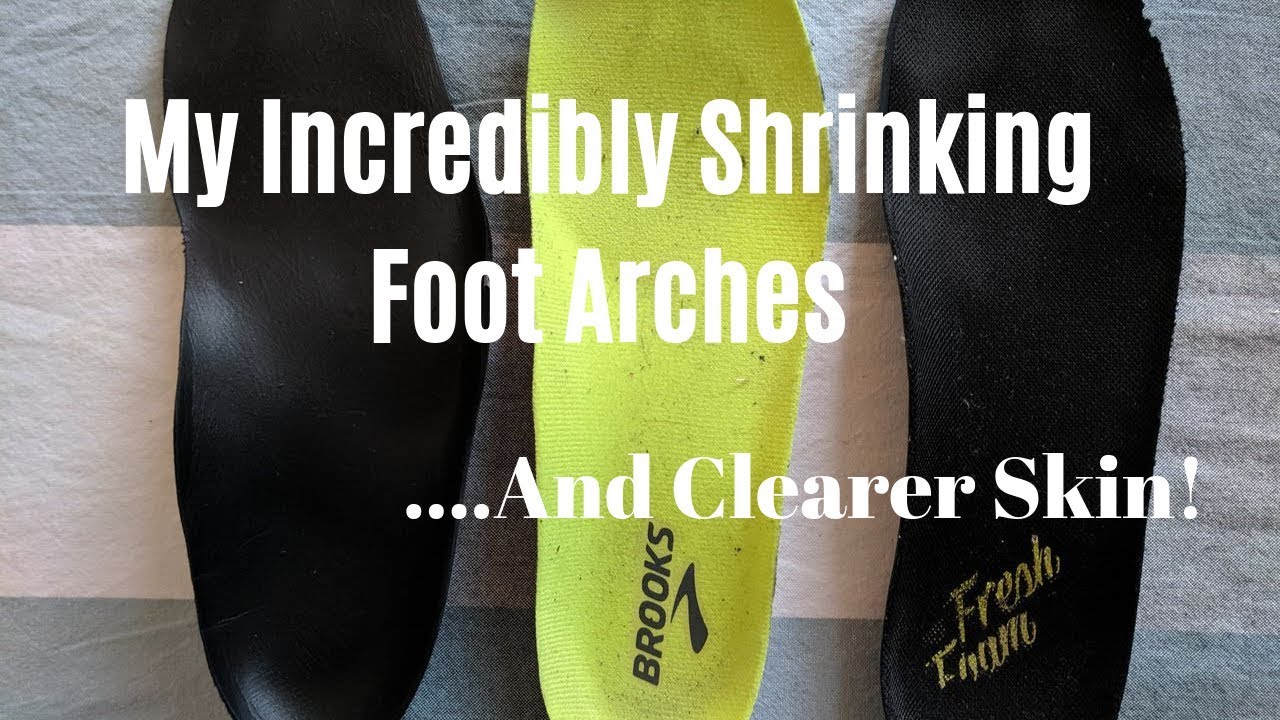 Grounding, Acne, and My Falling Foot Arches YouTube