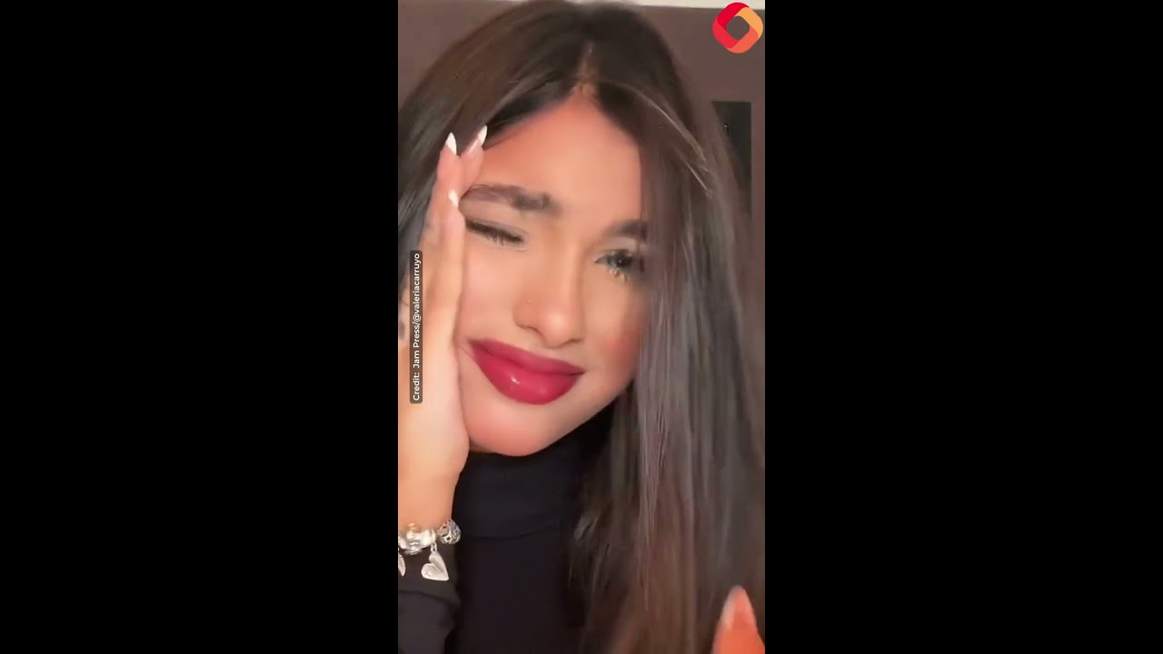 TikTok Star Viciously Attacked And Nearly Blinded By Her Own CAT Leaves Viewers Terrified