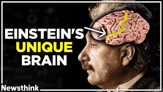 How Einstein’s Unique Brain Made Him Smarter