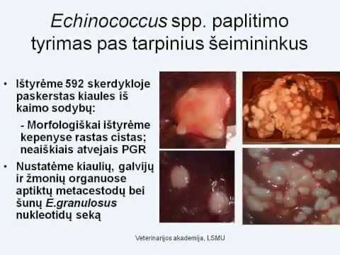 Video: Echinokokozė - Echinokokozės Priežastys, Simptomai Ir Diagnozė