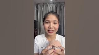Xử Lý Mụn Sữa Đầu Ti Gây Tắc Tia Sữa | Milena Mẹ Sữa Hạnh Phúc
