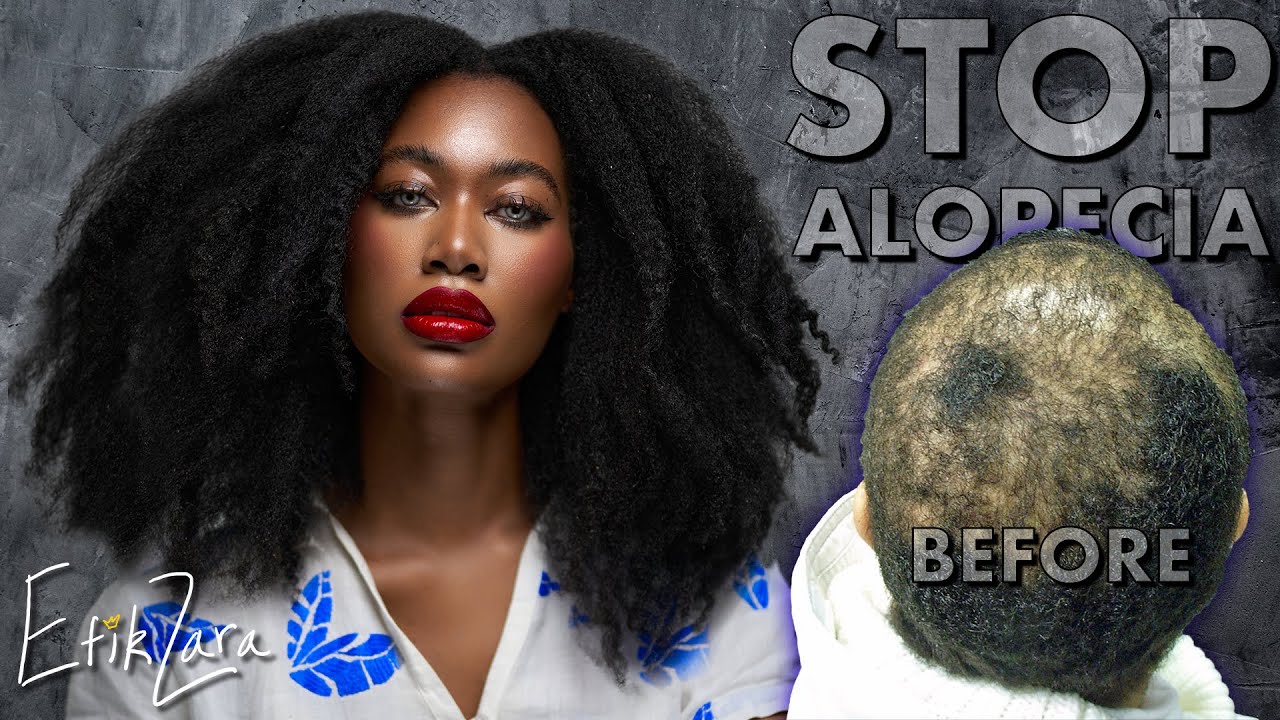 MIRACLE HAIR GROWTH NEVER Do These 7 THINGS Or Your Hair WON'T GROW