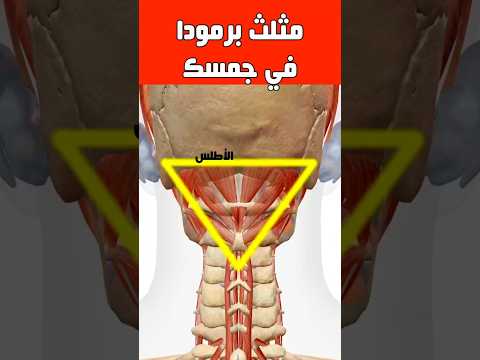 الأطلس مثلث برمودا الغامض صداع تنميل دوخة زغللة طنين غثيان التوازن إغماء مفاجئ