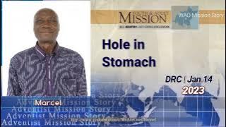 Adventist Mission Story, January 14, 2023 | Youth & Adult Mission - Hole in Stomach