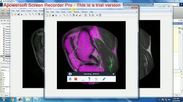 MATLAB MULTIMODAL MRI IMAGES