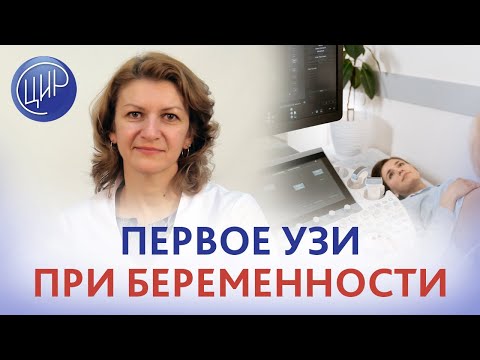 Видео: Как сделать УЗИ при беременности: 7 шагов (с иллюстрациями)