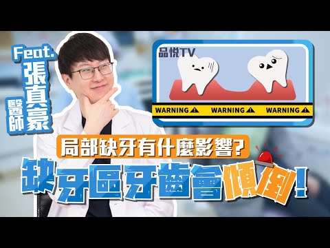 原來牙齒會往缺牙區傾倒！局部缺牙的影響有哪些？Ft.張真豪醫師【品悅牙醫】