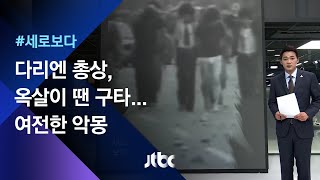 [세로보다] 다리엔 총상, 옥살이 땐 구타…여전한 악몽 / JTBC 뉴스룸