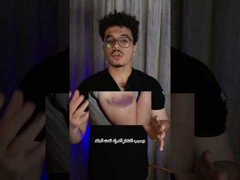 ازاي تدي  او  تحت الجلد من غير ما يحصل كدمه  تمريض   مستشفى