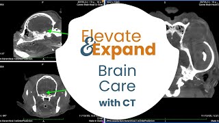 Elevate &amp; Expand your BRAIN care with CT