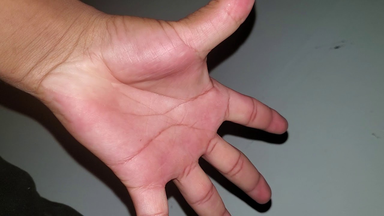 Como saber cuantos dedos tienes en la mano - YouTube