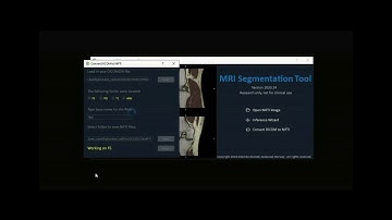 Dicom to Nifti conversion
