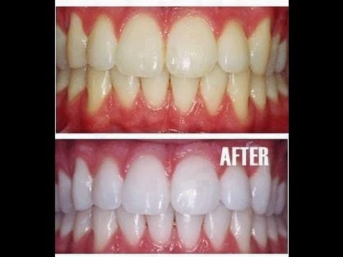 How To Make Your Skin Whiter In Natural Way How To Make Your Skin Whiter In Natural Way